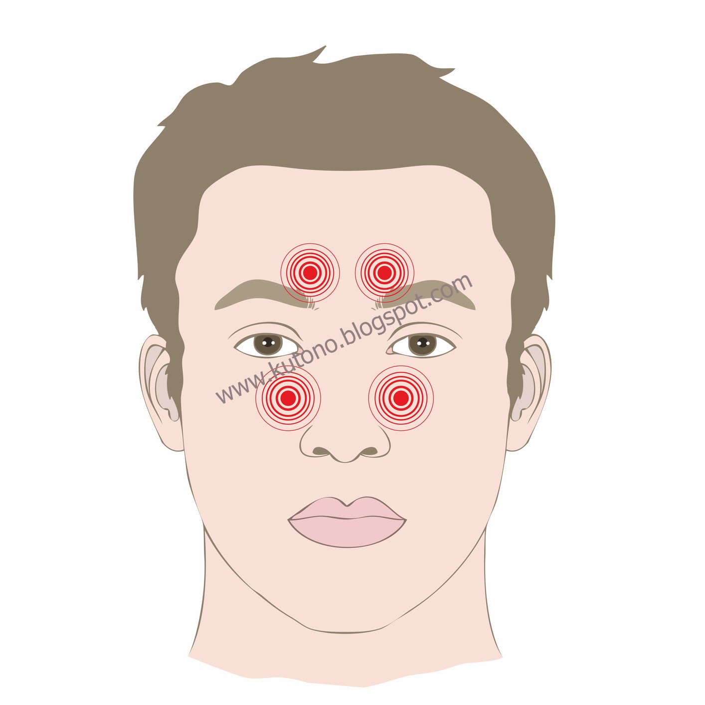 передается ли гайморит воздушно капельным путем