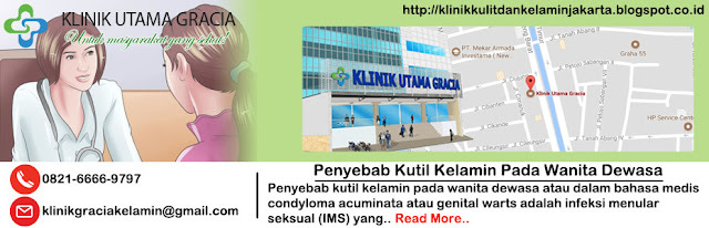 penyebab kutil kelamin pada wanita dewasa penyebab kutil kelamin pada wanita dewasa
