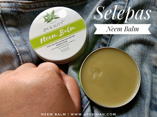 Neem Balm Keluaran ZM Beauty Membantu Mengurangkan Masalah Tumit Kaki Pecah Neem Balm Keluaran ZM Beauty Membantu Mengurangkan Masalah Tumit Kaki Pecah