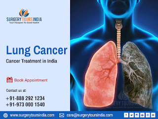 Lung Cancer surgery In India