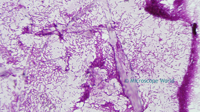 Fein Optic RB30 microscopy image of bacteria at 400x.