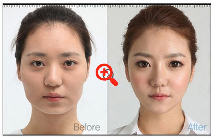 cosmetic plastic  Surgery