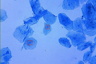 Células mejilla humana con azul de metileno