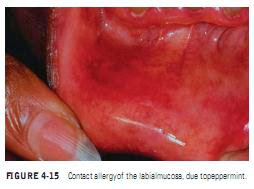 contact stomatitis #10