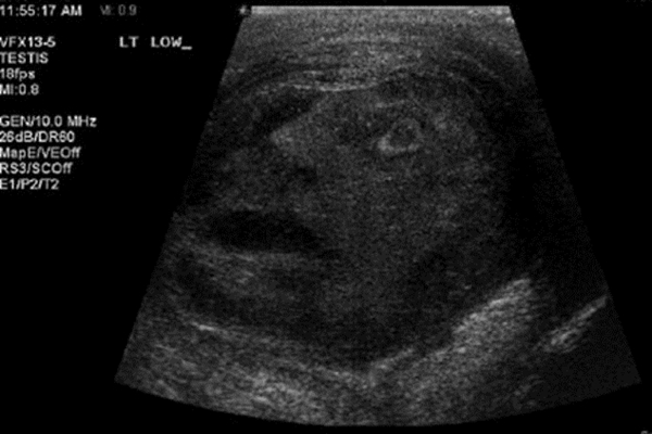 foto usg bayi paling mengerikan dan juga menyeramkan yang membuat bulu kuduk berdiri-22