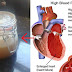 Tekanan Darah Tinggi Dan Kolesterol Bisa Sembuh Berkat Minuman Ini !! Begini Cara Membuat Minuman Jus nya.