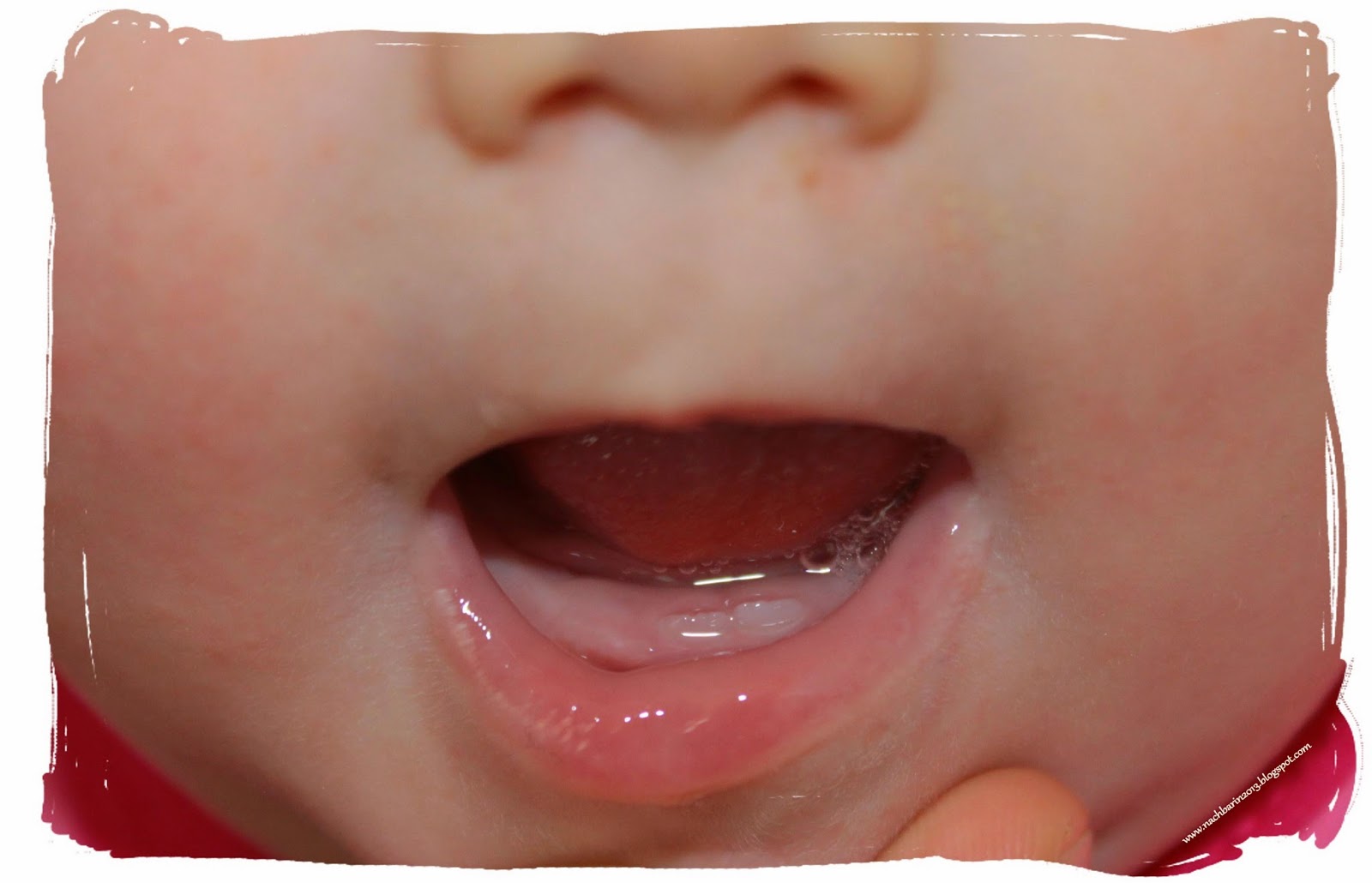 zahndurchbruch baby bilder