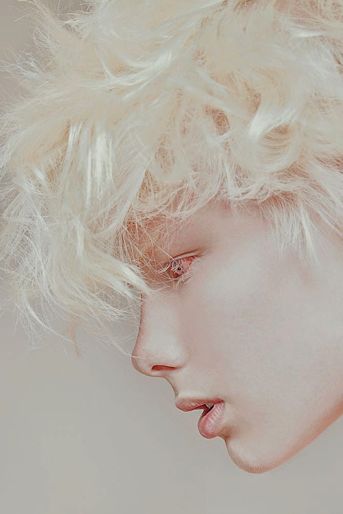 тотальный альбинизм. Conor mclain модель. саша смирнов альбинос. бенджамин джарвис. бледная кожа у мужчин.