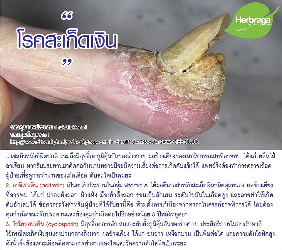 My Image 38