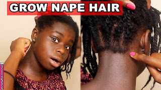How to Grow Your Nape Hair | Discovering Natural