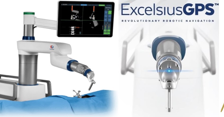 excelsius gps robotic surgical system