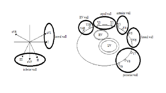 อัพเดตความรู้วันนี้: Consecutive leads ที่ติดกันนั้น ...