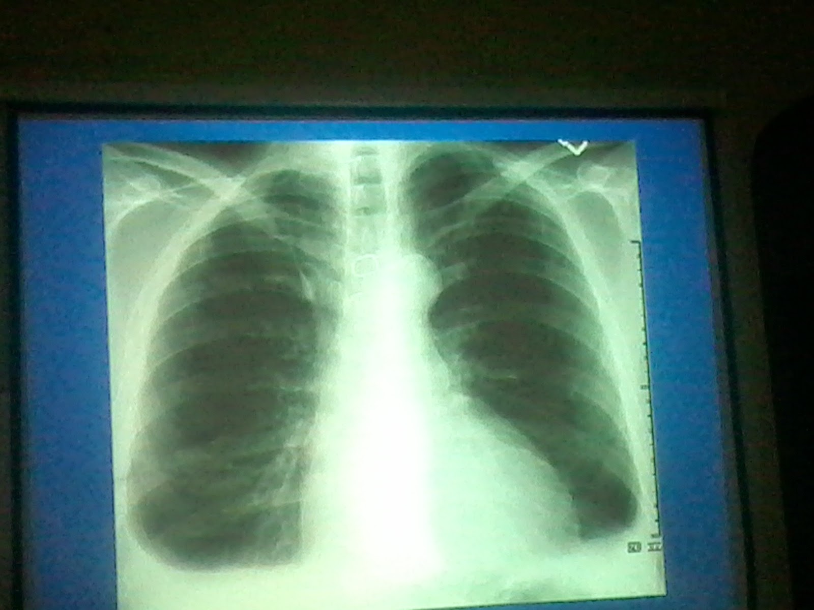 Lecture slides Radiology chest X ray