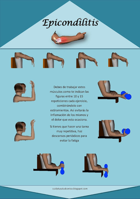 Epicondilitis