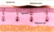 PYNOCARE : Pigmentation