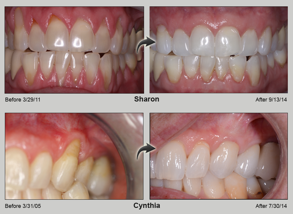 Lisa Wentz Lubbock Periodontics 2016