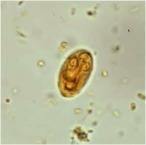 mialatt giardiasis)