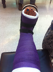 cast decoration leg decorating cool funny