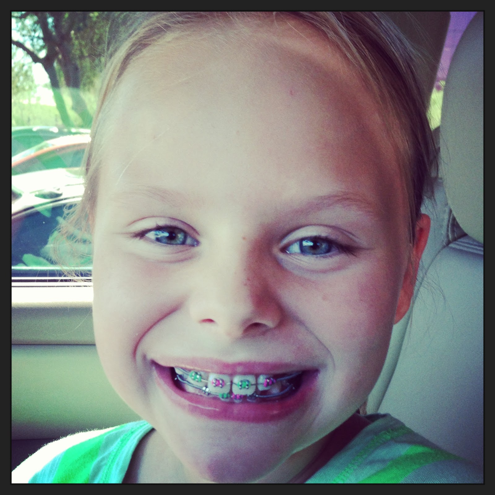 How To Avoid Braces Pain / How to Avoid Pain When Your Braces Are