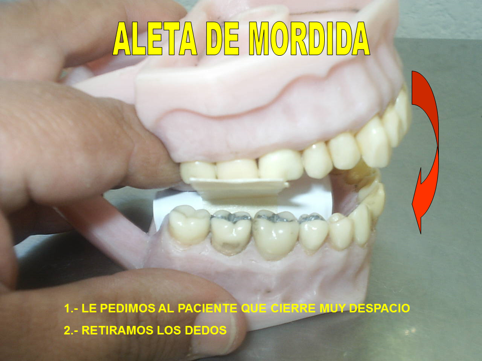 Radiología: 2° PARCIAL OCLUSAL Y ALETA DE MORDIDA