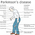 Apa yang jadi Penyebab Utama Penyakit Parkinson