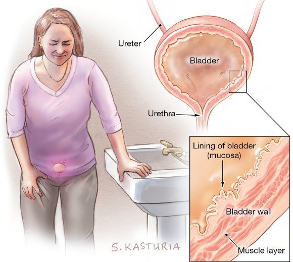 Ivy Acupuncture Acupuncture for urethra pain
