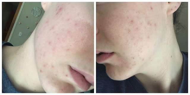 alani nu balance for men