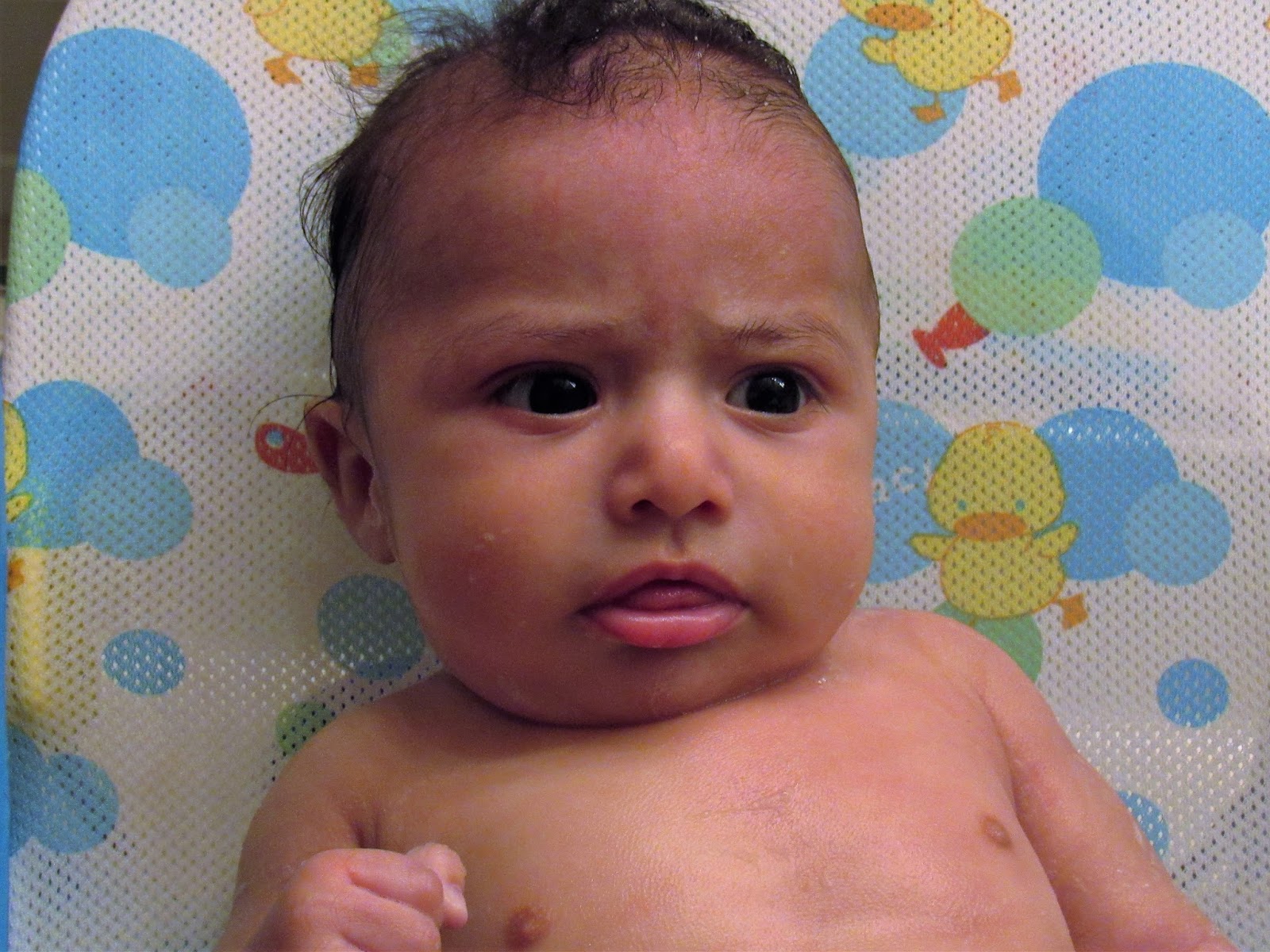 Bathing A Clubfoot Baby Writing Mother Fashionista