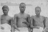 Fuente: https://www.zimeye.net/2018/03/14/disturbing-pictures-a-nightmare-in-heaven-horror-genocide-in-the-drc-under-kabilas-watch/ Manos cortadas