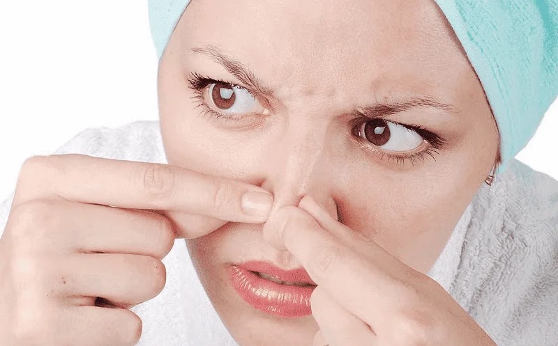 التخلص و ازالة الرؤوس السوداء من الانف نهائيا
