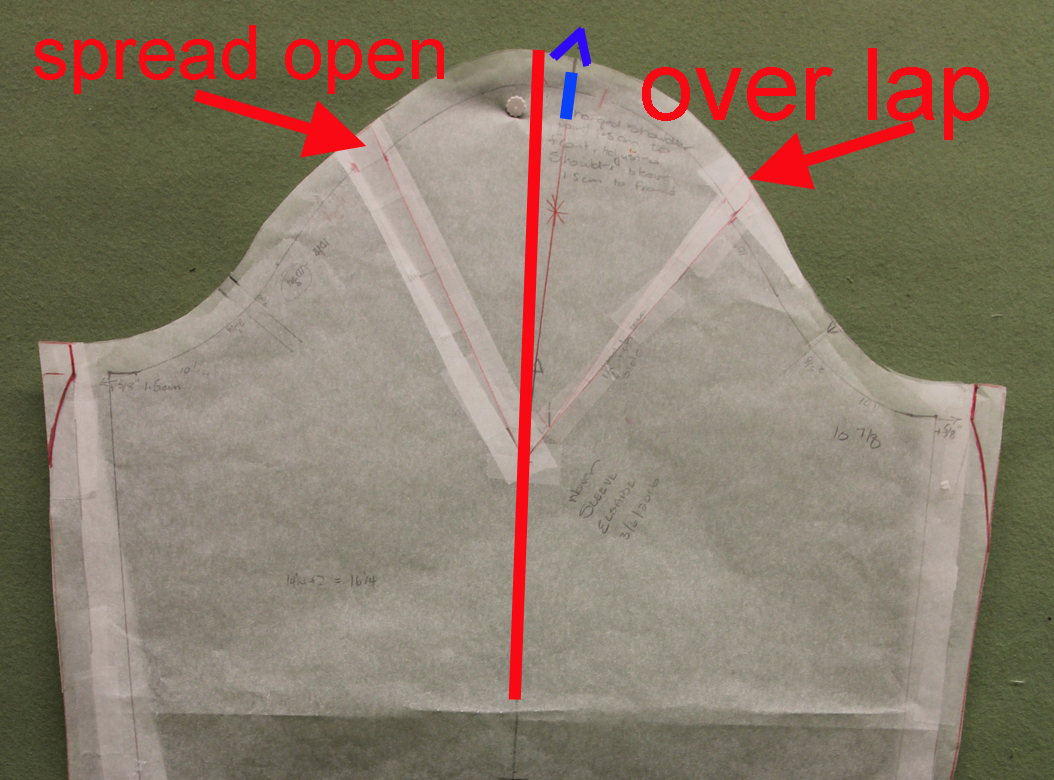 SureFit Designs™ Blog Forward Thrusted Shoulder