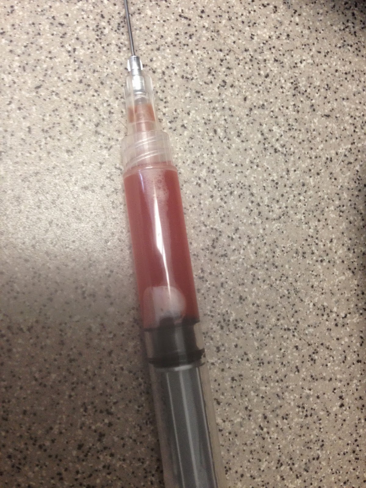 How to drain a seroma dog