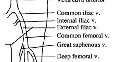Pedi cardiology: Venous anatomy - PICC line