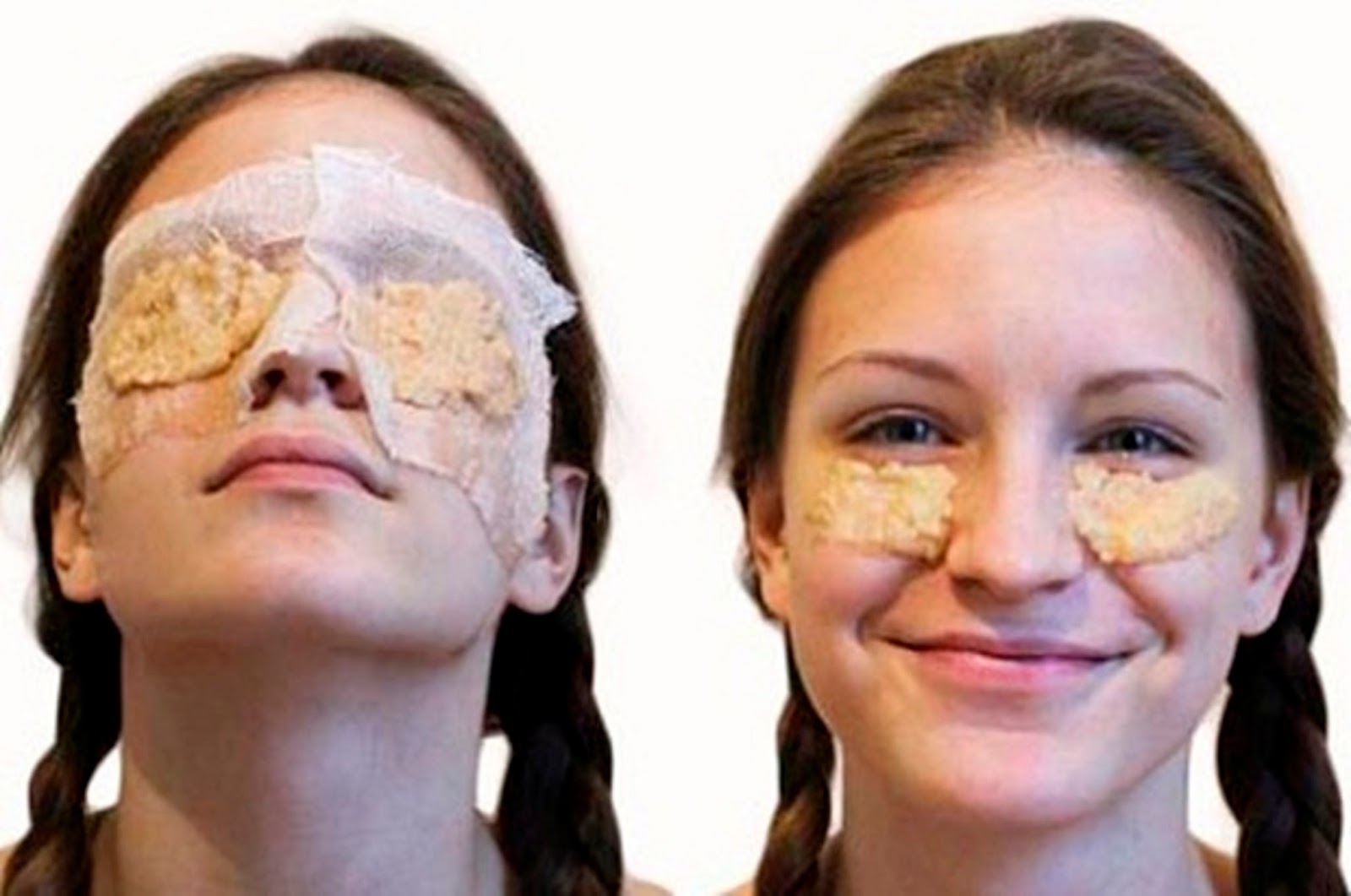 маска из картофеля для лица. картошка под глазами. маска для глаз из картофеля. картошка от отеков под глазами. маска для глаз из картофеля.