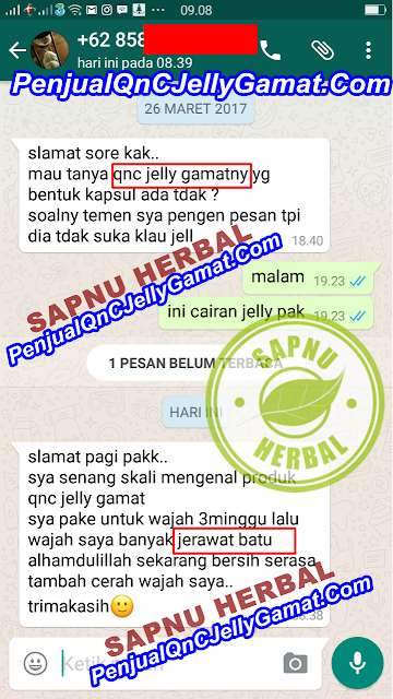 Cara Alami Menghilangkan Bopeng Bekas Jerawat Di Wajah Sampai Tuntas Cara Alami Menghilangkan Bopeng Bekas Jerawat Di Wajah Sampai Tuntas