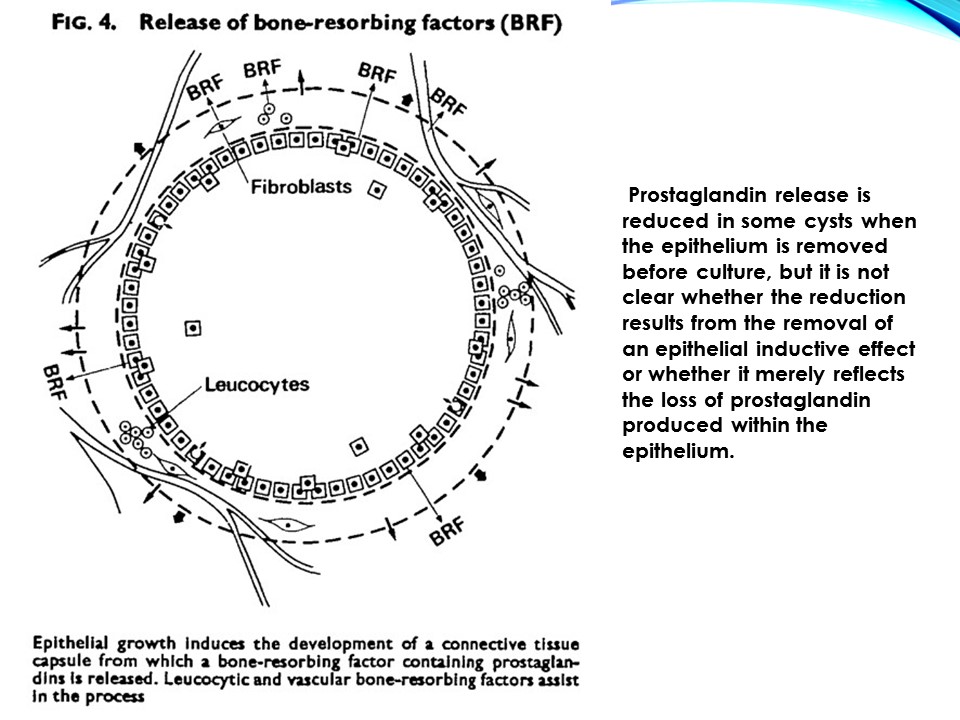 Dentosphere : World of Dentistry: Pathogenesis of 