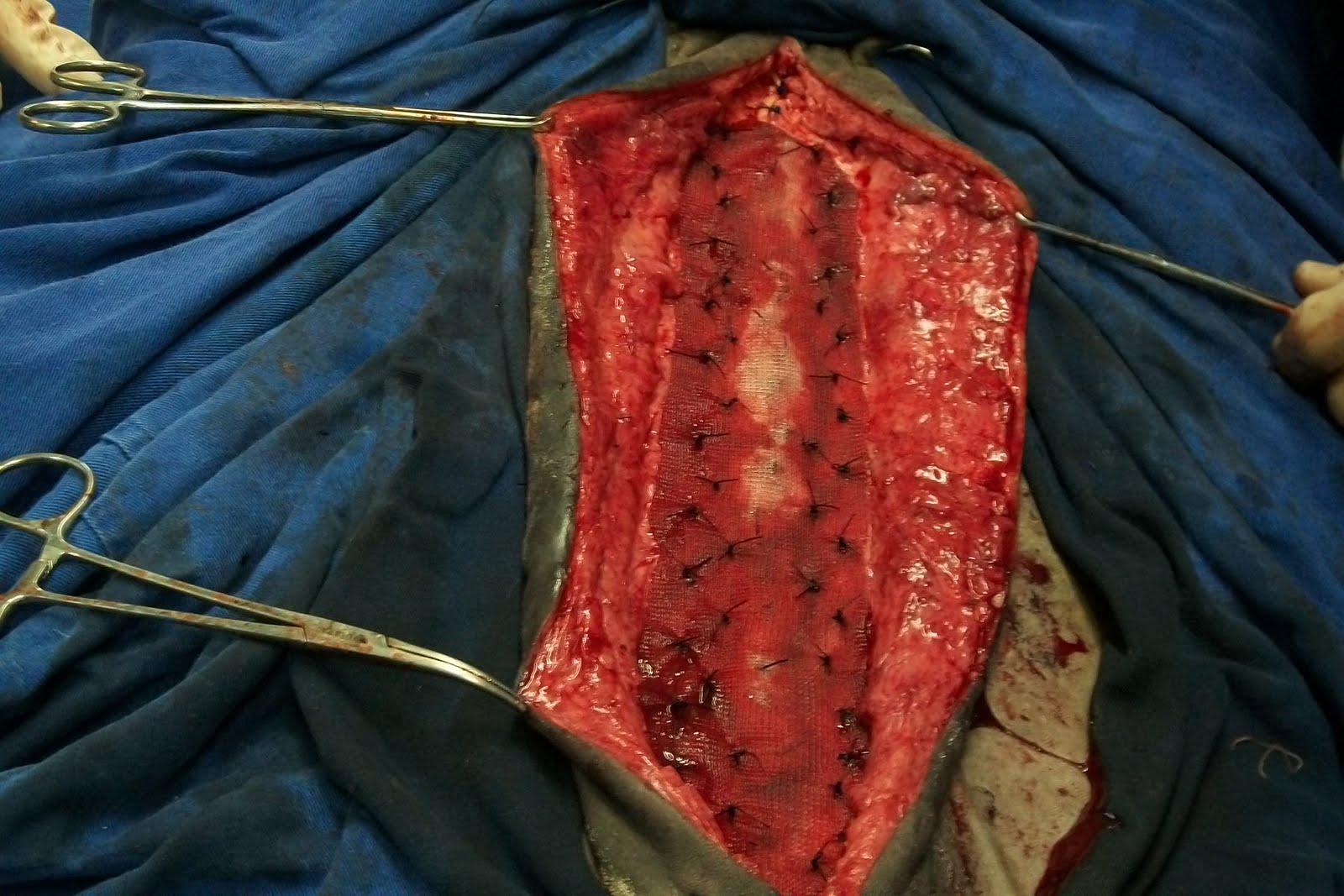 Medicina Veterinária: Cirurgia de hernia abdominal!