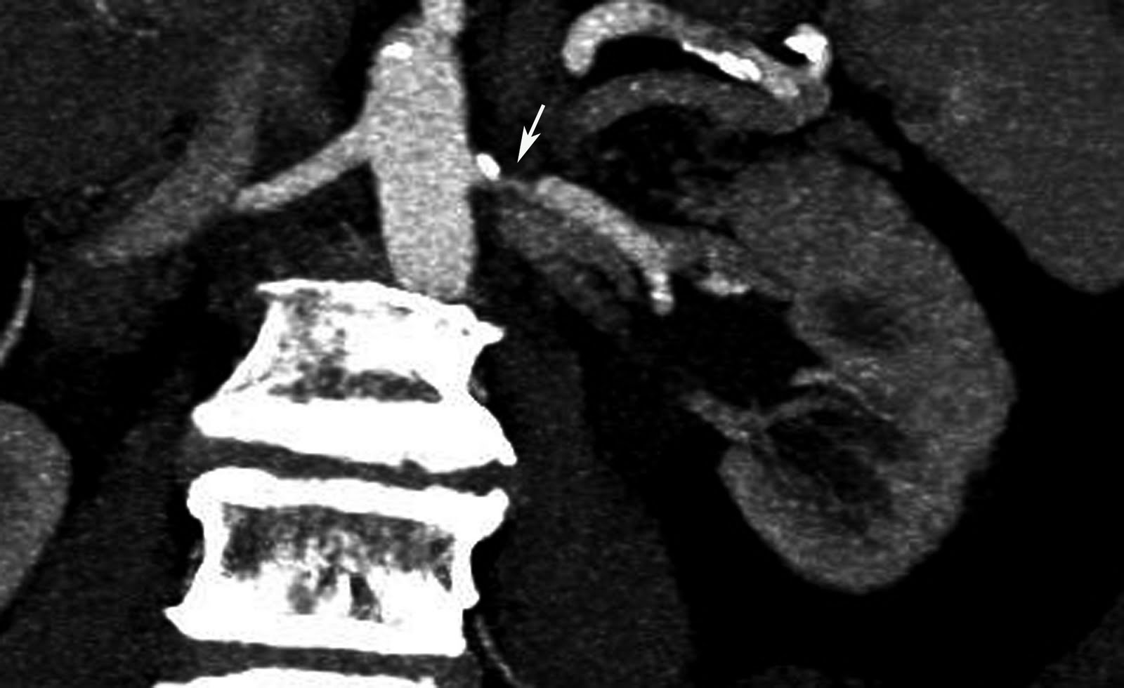 Radiodiagnosis Imaging is AmazingInteresting cases Renal artery