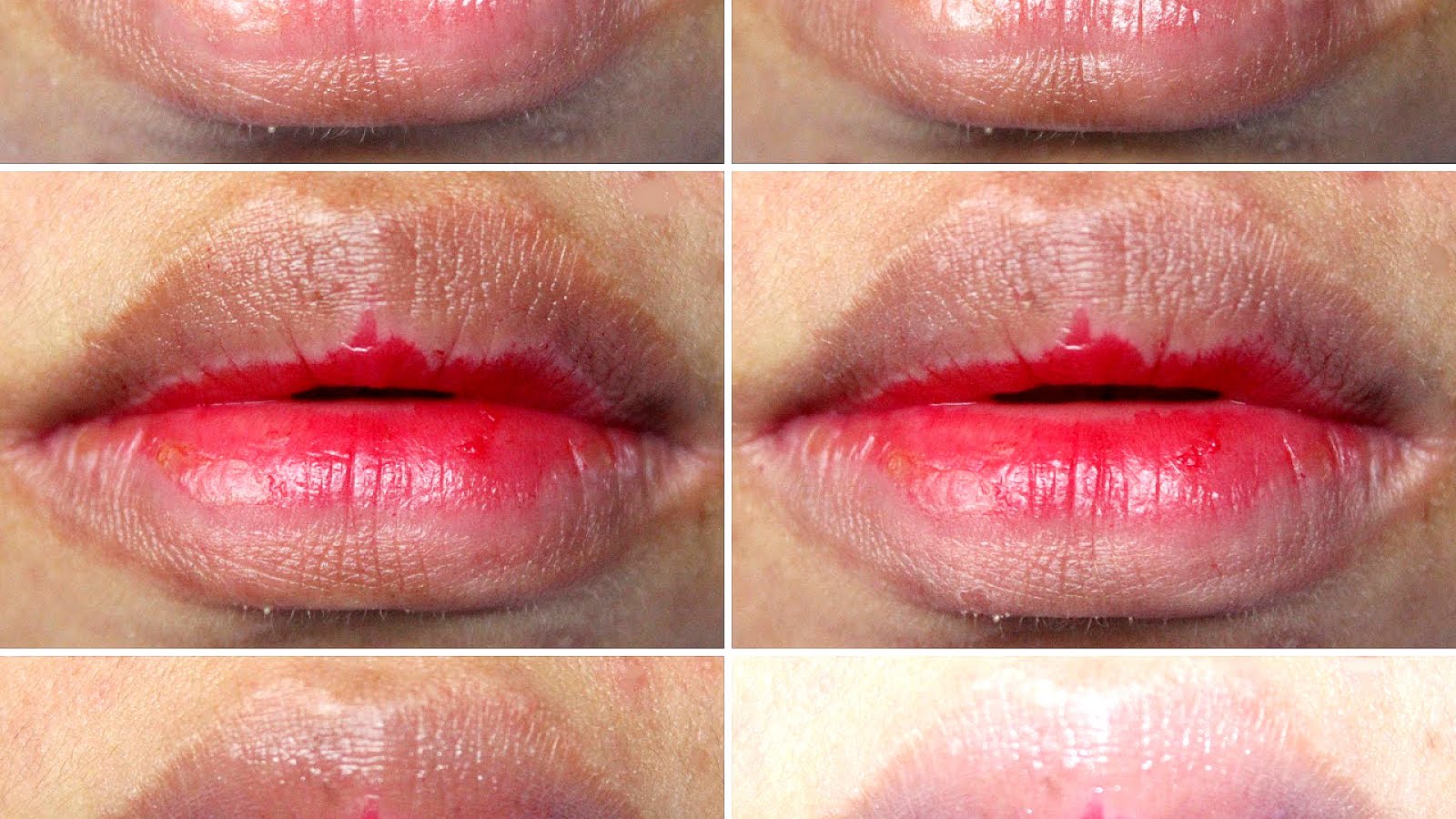 Lip Balm That Makes Lips Pink Pink Choices