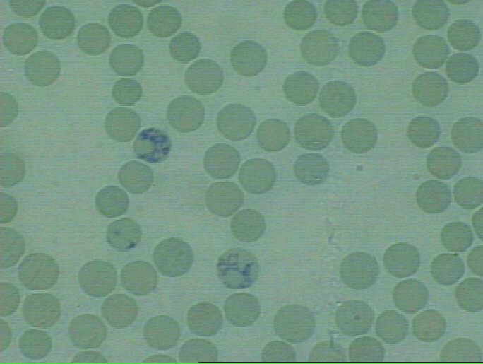 Sobre os reticulócitos