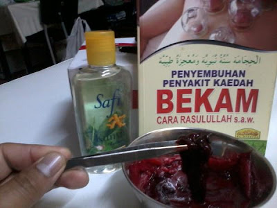 PUSAT BEKAM & RAWATAN ALTERNATIF BERDAFTAR PERHIJAM, GAPERA ( BADAN