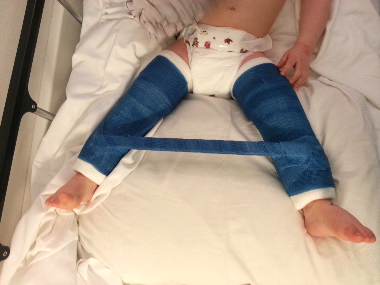 Связанные девушки в памперсах. Abdl бандаж. Segufix diaper Restraints straitjacket для мужчин в подгузниках