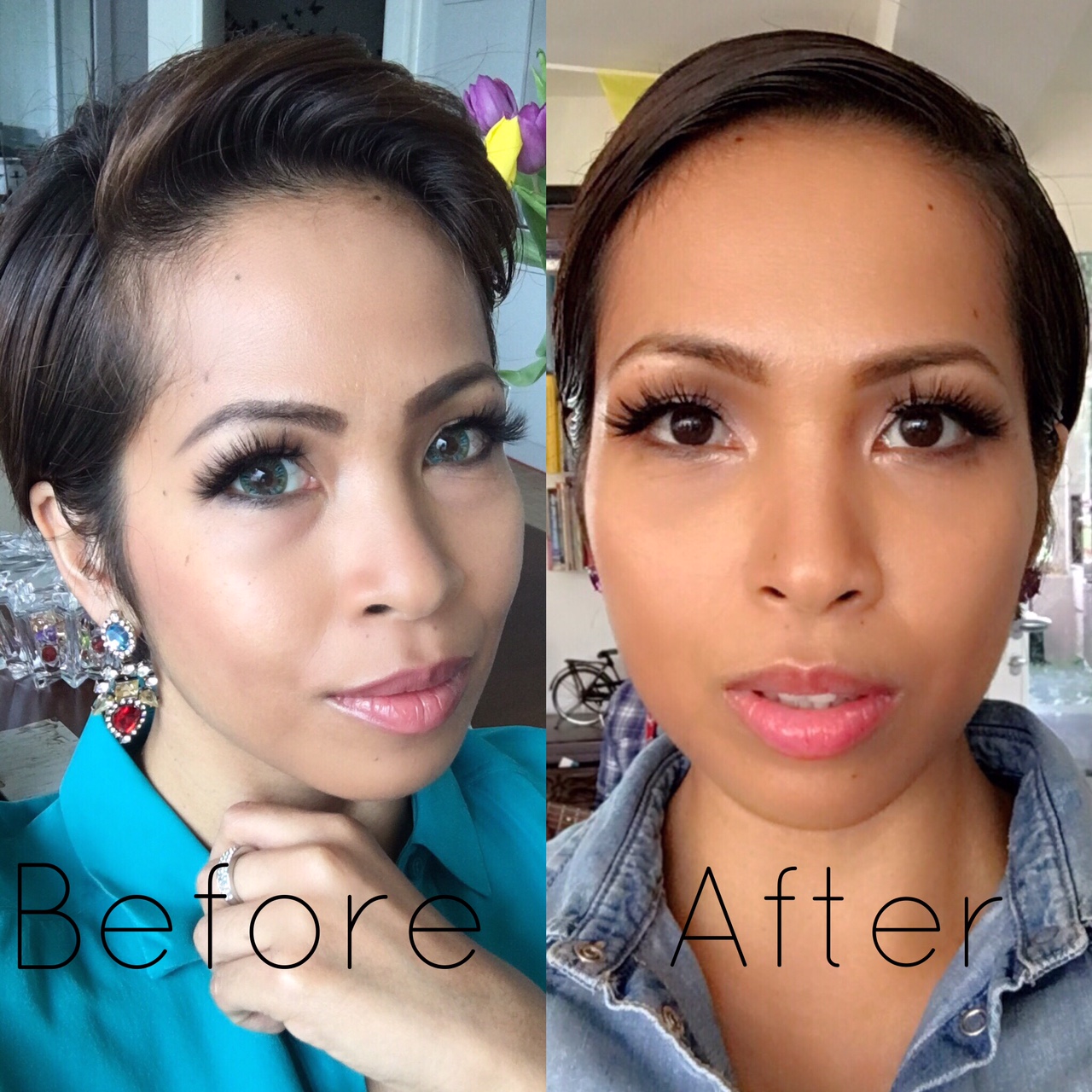 ID Hospital Korea How to look younger with under eye surgeries