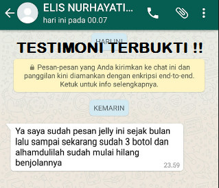 Cara Menghilangkan Benjolan Kecil Di Dalam Hidung Seperti Bisul Secara Alami ~ TESTIMONI QNC JELLY GAMAT Cara Menghilangkan Benjolan Kecil Di Dalam Hidung Seperti Bisul Secara Alami ~ TESTIMONI QNC JELLY GAMAT