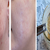 Stop Your Problem With Dark Spots Without Spending Money Using These Ingredients