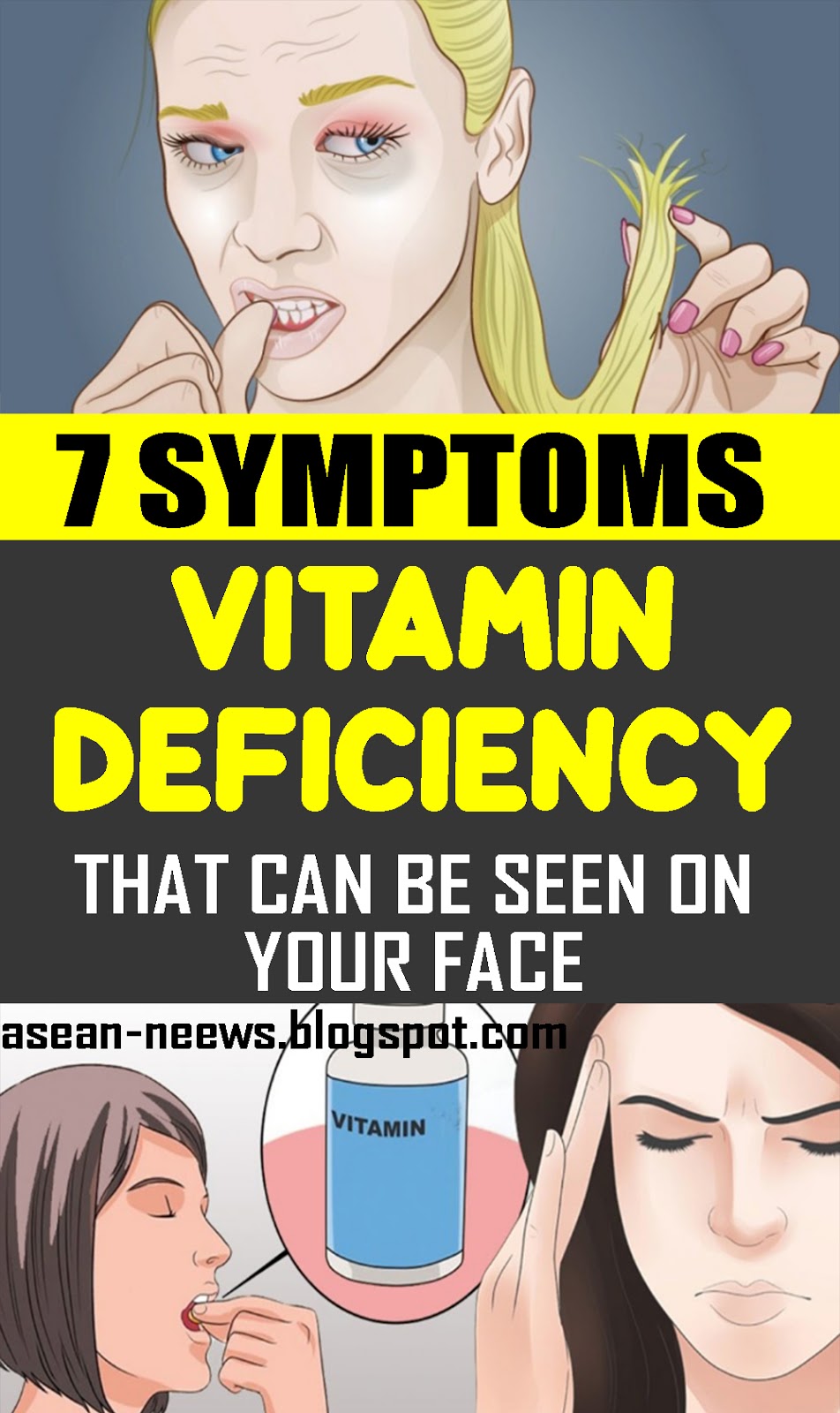 Vitamin Deficiency 7 Symptoms That Can Be Seen on Your Face