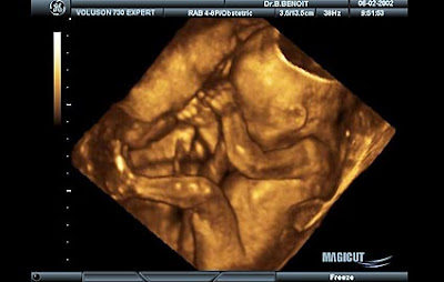 21 haftalık gebelik görüntüsü
