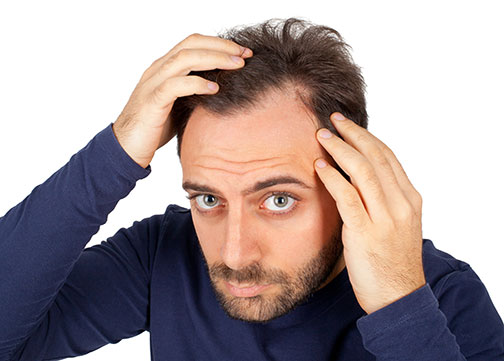 How To Reduce Hair Loss Without Using Any Expensive Product  How To Reduce Hair Loss Without Using Any Expensive Product
