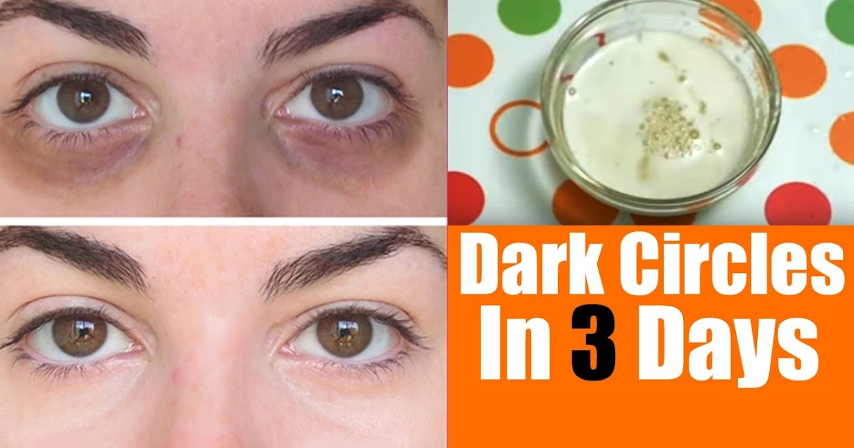 Home Remedies for Dark Circle Under Eyes TOP 5 DIY