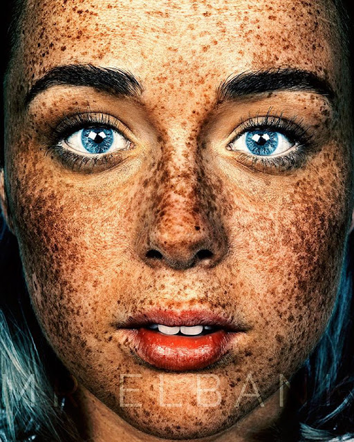 Freckles: verdadera belleza detrás pecas